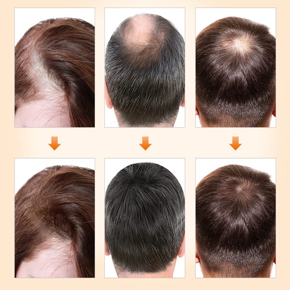 Natural Hair Density Essential Oil - Hair Growth Serum for Thicker Hair